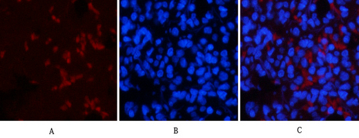 a00001t18 tp53 primary antibodies if testing 1