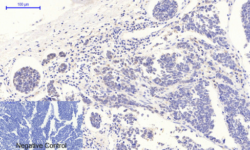 a00001t18 tp53 primary antibodies ihc testing 4