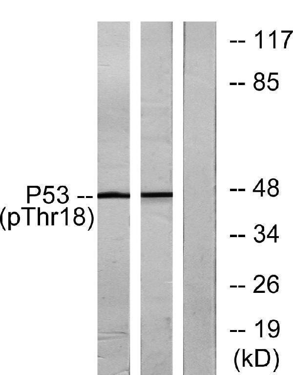 a00001t18 tp53 primary antibodies wb testing 3