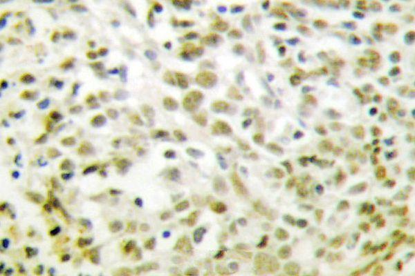a00001t310 tp53 primary antiboties ihc testing 2