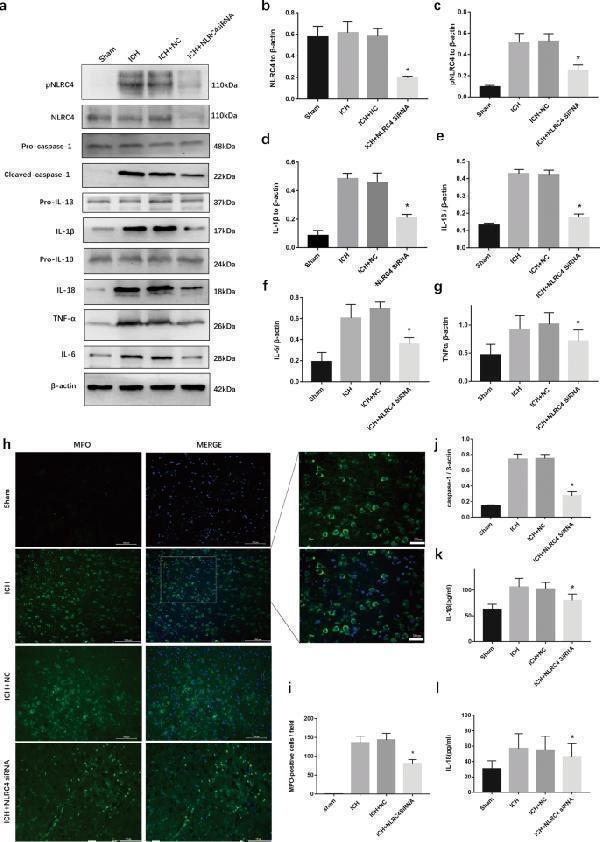 Inflammation response were reduced by NLRC4 siRNA after ICH