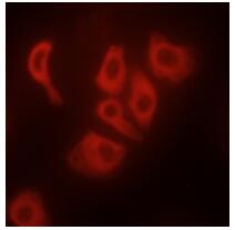 Immunofluorescent analysis of TNF-α staining in HepG2 cells