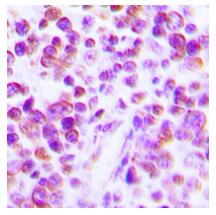 Immunohistochemical analysis of TNF-α staining in human tonsil formalin fixed paraffin embedded tissue section