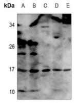 Western blot analysis of TNF-α expression in HEK293T (A), Hela (B), mouse lung (C), mouse kidney (D), mouse spleen (E) whole cell lysates
