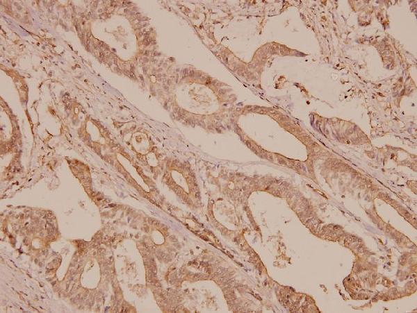 a00003s2442 mtor primary antiboties ihc testing 2