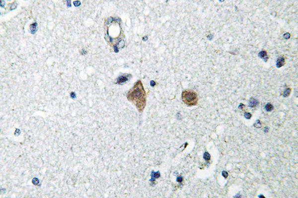 a00003s2448 mtor primary antiboties ihc testing 2