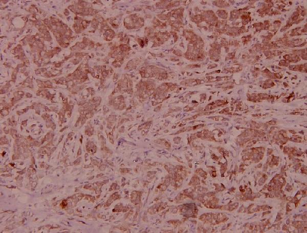 a00004s33s37t41 ctnnb1 primary antiboties ihc testing 2