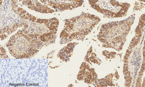 a00004s37 ctnnb1 primary antibodies ihc testing 4