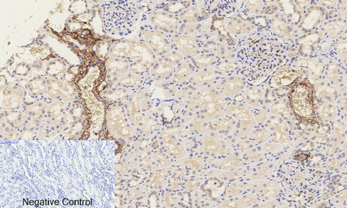 a00004s37 ctnnb1 primary antibodies ihc testing 5