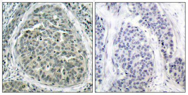a00004s37 ctnnb1 primary antibodies ihc testing 6