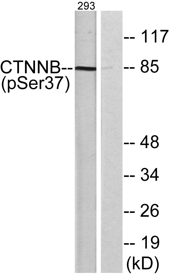 a00004s37 ctnnb1 primary antibodies wb testing 3
