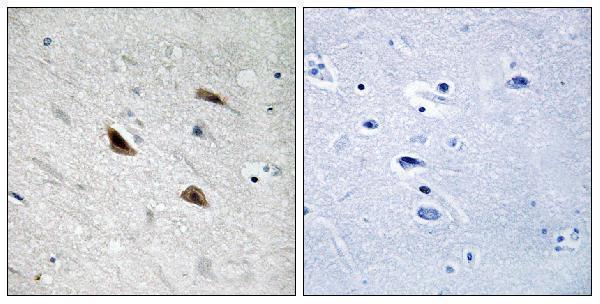 a00004y489 ctnnb1 primary antibodies ihc testing 3