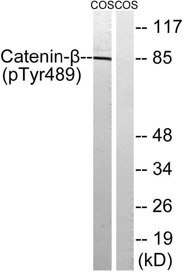a00004y489 ctnnb1 primary antibodies wb testing 2