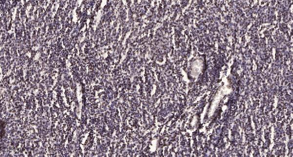 a00004y654 ctnnb1 primary antibodies ihc testing 4