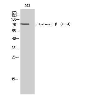 a00004y654 ctnnb1 primary antibodies wb testing 2