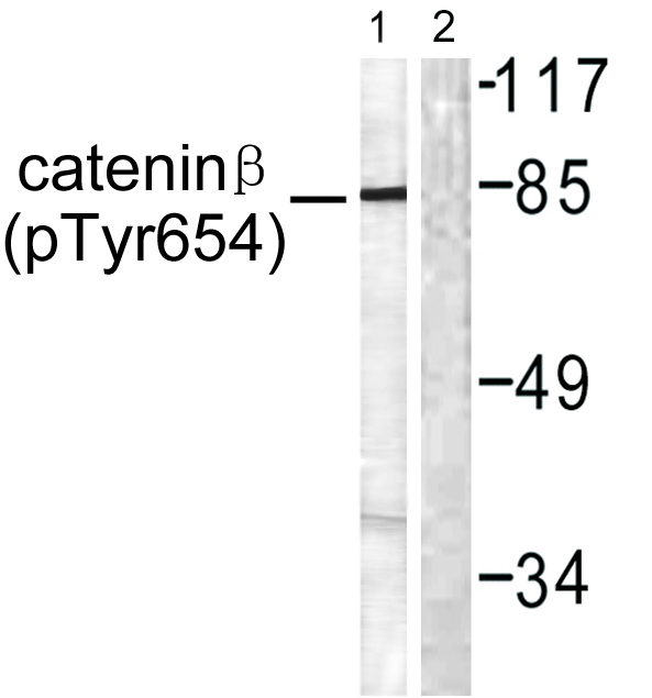 a00004y654 ctnnb1 primary antibodies wb testing 3