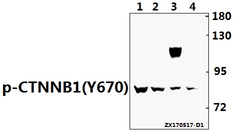 a00004y670 ctnnb1 primary antiboties wb testing 1