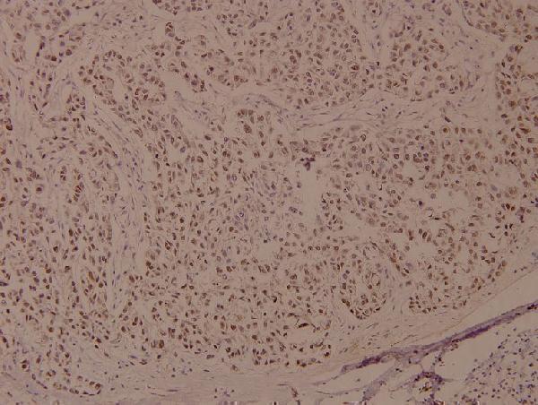 a00005s1524 brca1 primary antiboties ihc testing 2