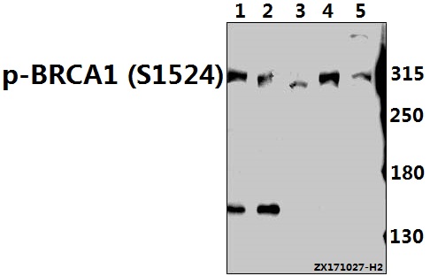 a00005s1524 brca1 primary antiboties wb testing 1