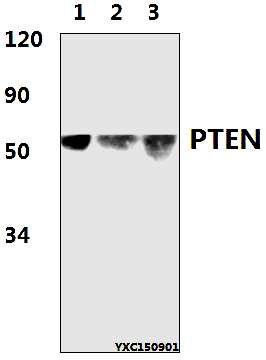 Western blot (WB) analysis of PTEN (D375) polyclonal antibody at 1:500 dillution
Lane1:HeLa whole cell lysate(50μg)
Lane2:PC12 whole cell lysate(50μg)
Lane3:RAW264