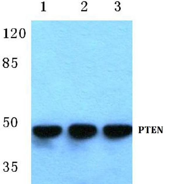 Western blot (WB) analysis of PTEN pAb at 1:500 dilution
Lane1:Hela whole cell lysate(30ug)
Lane2:3T3-L1 whole cell lysate(30ug)
Lane3:C6 whole cell lysate(30ug)                                                                                           Lane4:MCF-7 whole cell lysate(30ug)
Lane5:HepG2 whole cell lysate(30ug)