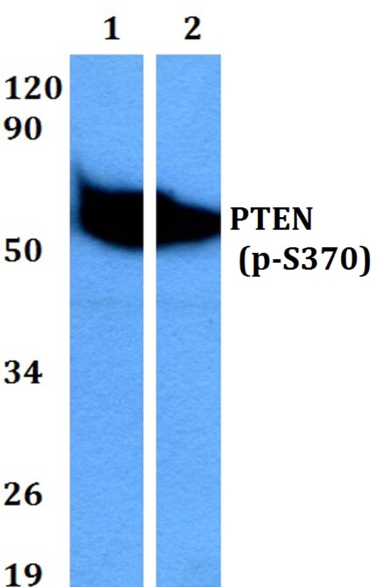 Western blot (WB) analysis of p-PTEN (S370) polyclonal antibody at 1:500 dilution
Lane1:A549 cell lysate treated with PMA(100nM,30mins)
Lane2:PC12 cell lysate treated with PMA(100nM,30mins)