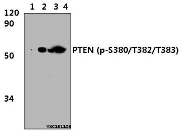 Western blot (WB) analysis of PTEN (p-S380/T382/T383) polyclonal antibody at 1:1000 dillution
Lane1:Hela whole cell lysate(30μg)
Lane2:Hela treated with PMA(60ng/ml, 30min) whole cell lysate(30μg)  Lane3:H9C2 whole cell lysate(30μg)   Lane4:H9C2 treated with PMA(60ng/ml, 30min) whole cell lysate(30μg) 