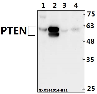Western blot (WB) analysis of PTEN (Y379) polyclonal antibody at 1:500 dilution
Lane1:L02 whole cell lysate(40ug)
Lane2:The Brain tissue lysate of Mouse(40ug)
Lane3:C6 whole cell lysate(40ug)
Lane4:The Kidney tissue lysate of Mouse(40ug)