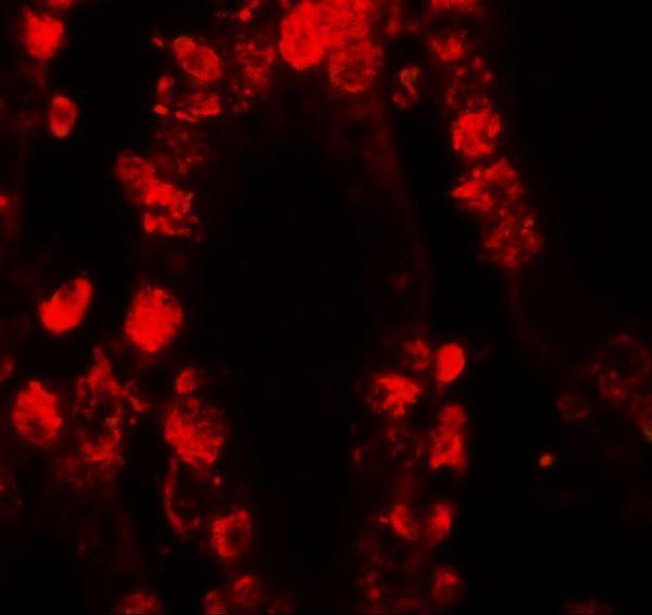 Immunofluorescence of STAT3 in human small intestine tissue with STAT3 antibody at 20 μg/ml