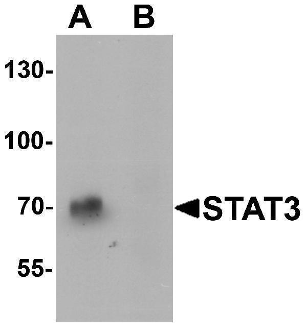 Western blot analysis of STAT3 in human small intestine tissue lysate with STAT3 antibody at 1 μg/mL in (A) the absence and (B) the presence of blocking peptide