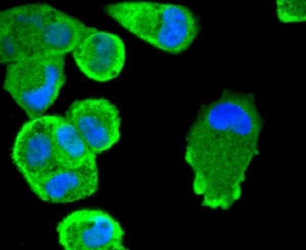 ICC staining STAT3 in Hela cells (green)