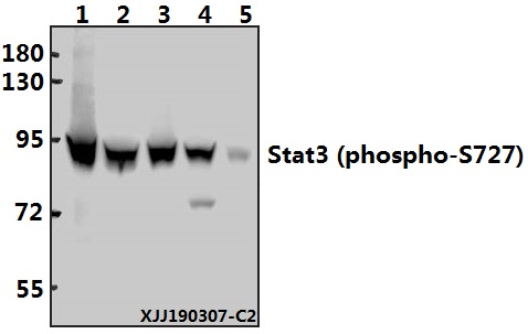 Western blot (WB) analysis of Stat3 (phospho-S727) polyclonal antibody at 1:500 dilution
Lane1:HepG2 whole cell lysate(40µg)
Lane2:A549 whole cell lysate(40µg)
Lane3:L02 whole cell lysate(40µg)
Lane4:PC12 whole cell lysate(40µg)
Lane5:3T3-L1 whole cell lysate(40µg)