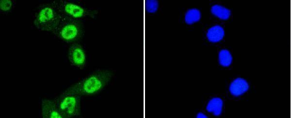 ICC staining Phospho-STAT3(S727) in Hela cells (green)