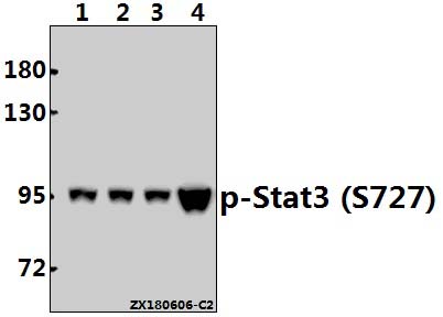 Western blot (WB) analysis of p-Stat3 (S727) pAb at 1:2000 dilution
Lane1:Hela whole cell lysate(40ug)
Lane2:MCF-7 whole cell lysate(40ug)
Lane3:AML-12 whole cell lysate(40ug)
Lane4:C6 whole cell lysate(40ug)