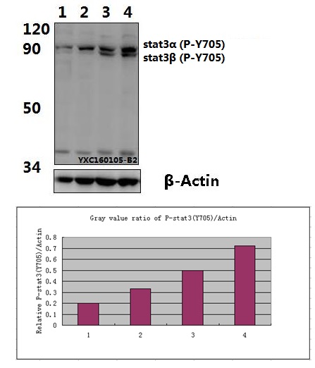 Western blot (WB) analysis of Stat3 (phospho-Y705) polyclonal antibody at 1:500 dillution
Lane1:Hela whole cell lysate(40μg)
Lane2:Hela treated with IFN-γ(100ng/ml, 30min) whole cell lysate(40μg)
Lane3:Jurkat whole cell lysate(40μg)
Lane4:Jurkat treated with H2O2(100nM/ml, 30min) whole cell lysate(40μg)