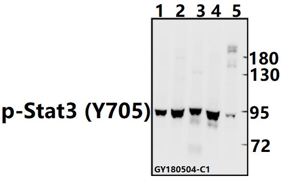 Western blot (WB) analysis of p-Stat3 (Y705) pAb at 1:500 dilution
Lane1:U-87MG whole cell lysate(40ug)
Lane2:H9C2 whole cell lysate(40ug)
Lane3:The Embryo tissue lysate of Mouse(40ug)
Lane4:A375 whole cell lysate(40ug)
Lane5:HepG2 whole cell lysate(40ug)