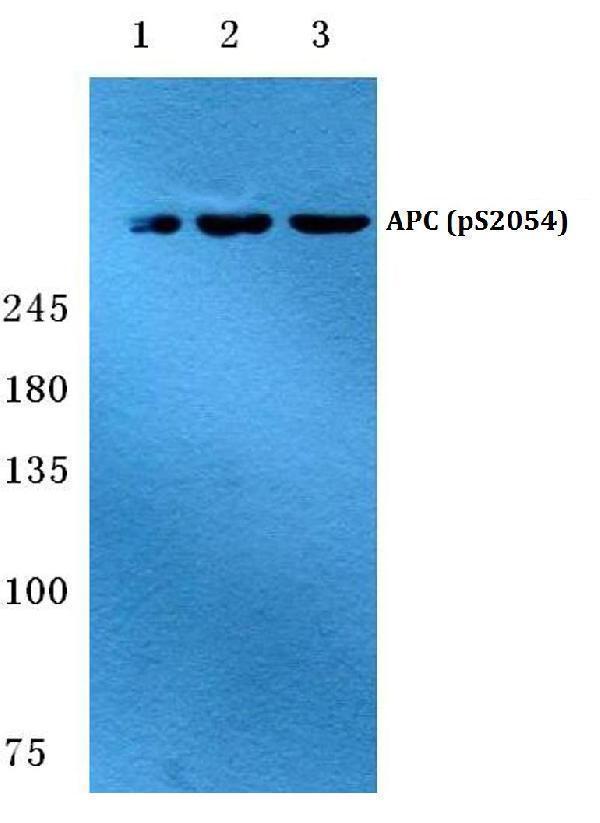 Western blot (WB) analysis of p-APC (S2054) polyclonal antibody at 1:500 dilution
Lane1:MCF-7 cell lysate
Lane2:sp2/0 cell lysate
Lane3:PC12 cell lysate