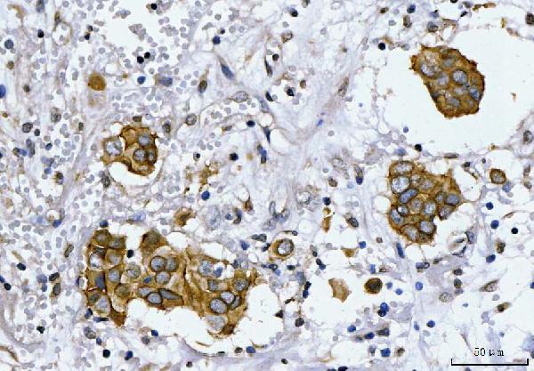 a00010 4 erbb2 primary antibodies ihc testing 2