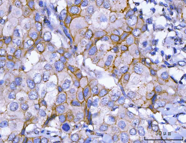a00010 5 erbb2 primary antibodies ihc testing 2