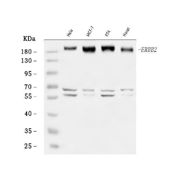 a00010 5 erbb2 primary antibodies wb testing 1