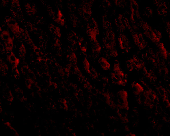 a00010 erbb2 primary antibodies if testing 3