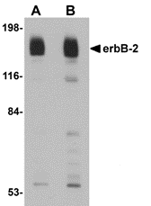 a00010 erbb2 primary antibodies wb testing 1