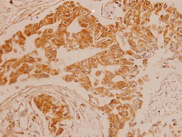 a00010t1242 erbb2 primary antiboties ihc testing 2