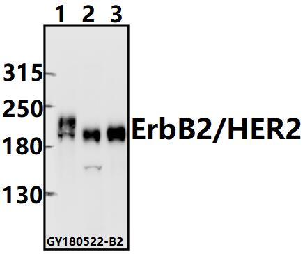 a00010t1242 erbb2 primary antiboties wb testing 1