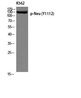 a00010y1112 erbb2 primary antibodies wb testing 2