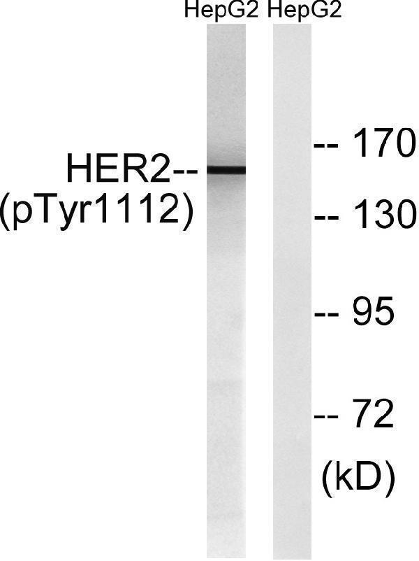 a00010y1112 erbb2 primary antibodies wb testing 3