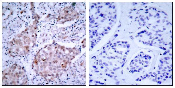 a00010y1221y1222 1 erbb2 primary antibodies ihc testing 1