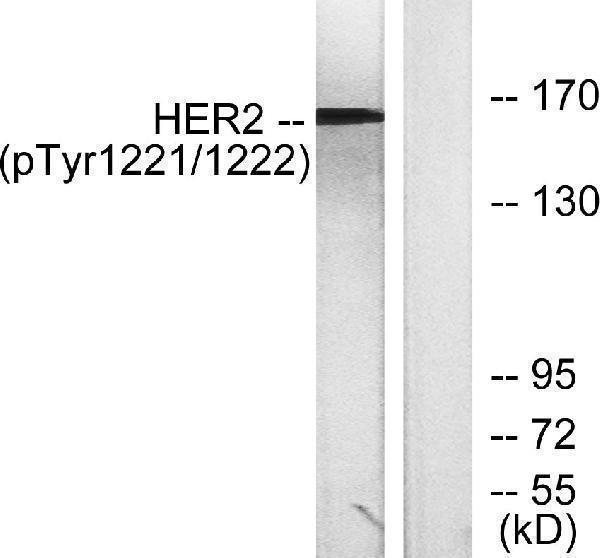 a00010y1221y1222 1 erbb2 primary antibodies wb testing 3