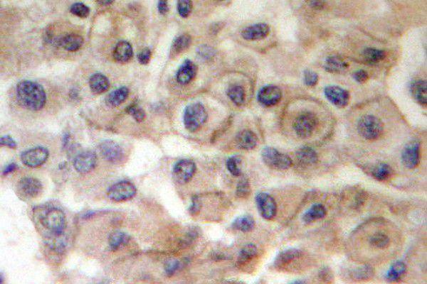 a00010y1221y1222 erbb2 primary antiboties ihc testing 2