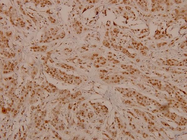 a00010y1248 1 erbb2 primary antiboties ihc testing 2